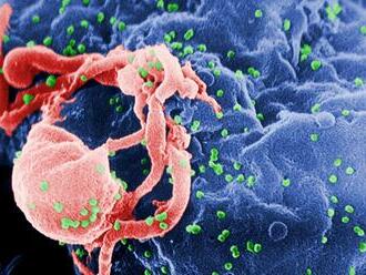 Nová očkování na HIV zkouší jiný přístup, první výsledky jsou slibné
