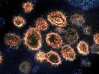 Čína kritizuje americký zákon, který má odtajnit informace o původu koronaviru