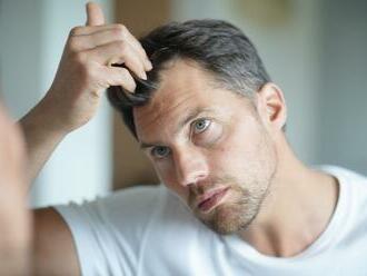 Najčastejšie príčiny vypadávania vlasov. Ako proti nim účinne bojovať?