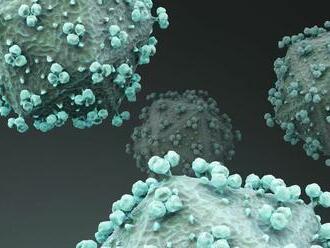 Vedci dokázali z buniek „vystrihnúť“ HIV