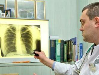 Covid zvrátil pokrok dosiahnutý pri liečbe tuberkulózy, máme viac nakazených