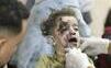 v Pásme Gazy zomrelo bábätko zachránené z maternice umierajúcej matky