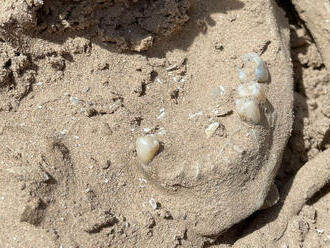 V zuboch z doby bronzovej objavili DNA baktérií spôsobujúcich zubný kaz