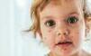 WHO a UNICEF: V Európe sa prudko šíria osýpky, ohrozujú milióny detí